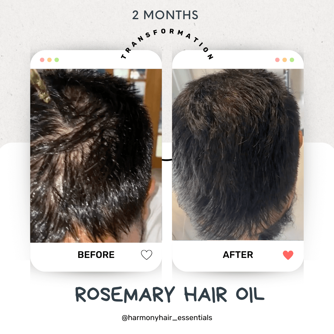 Rosemary Hair Oil ™ - Harmony Hair Essentials